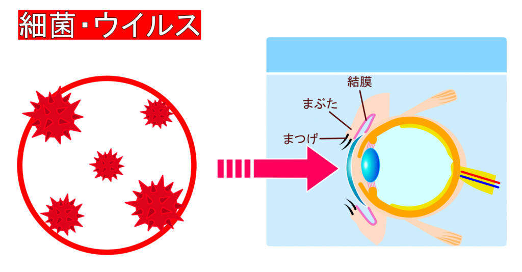 結膜炎 保谷駅前つだ眼科
